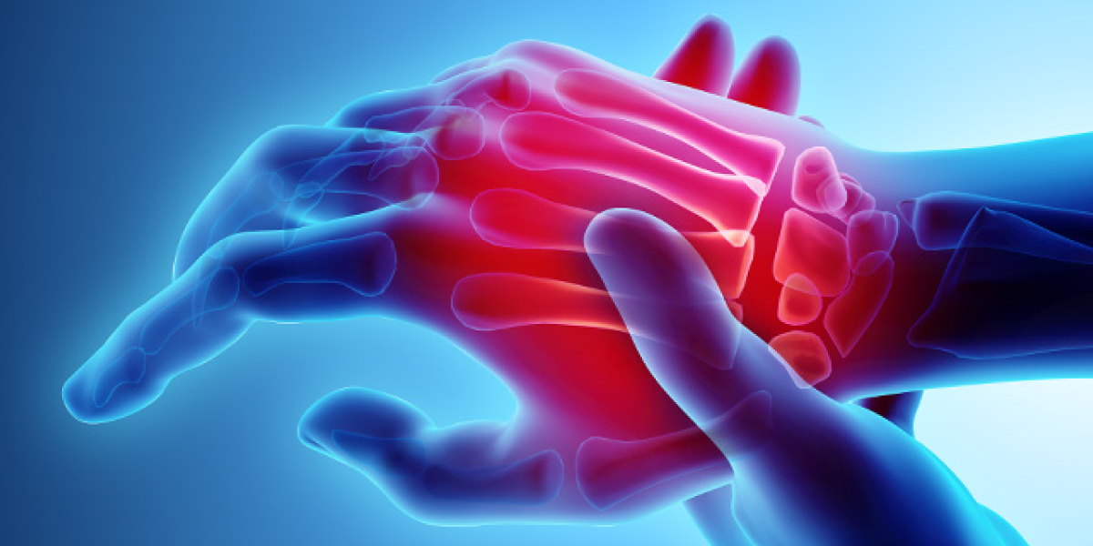 Signs of Early Arthritis in Hands Treatment