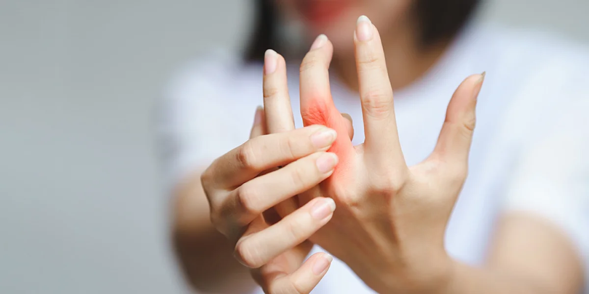 What Are the 4 Stages of Rheumatoid Arthritis?