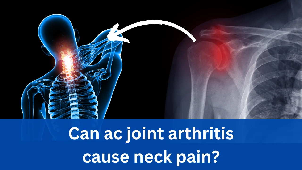 Can ac joint arthritis cause neck pain?