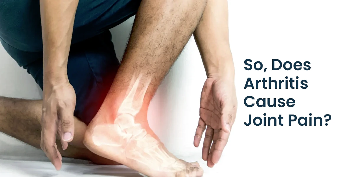 Does Arthritis Cause Joint Pain?