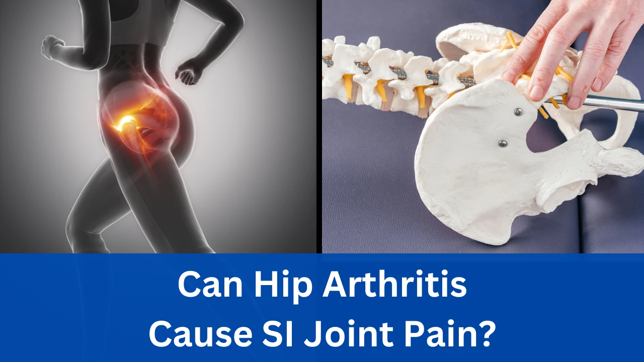 Understanding the Connection Can Hip Arthritis Cause SI Joint Pain