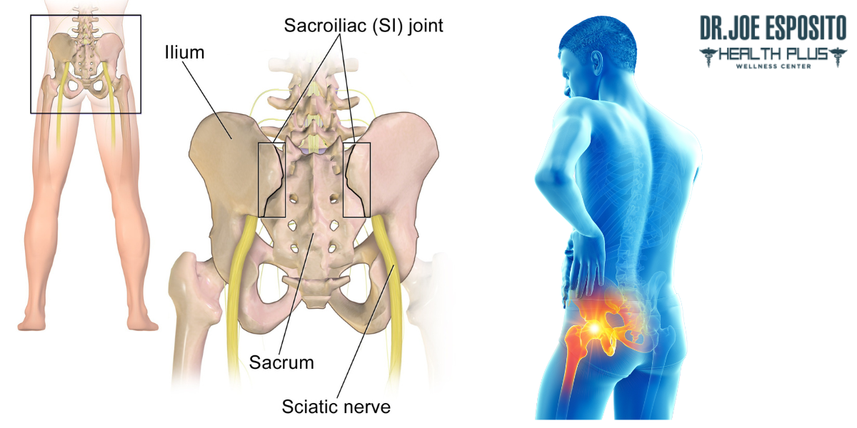 What is SI Joint Pain